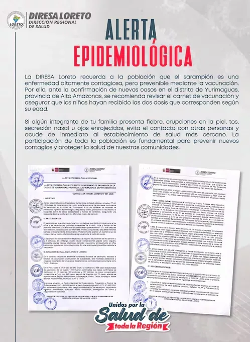Comunicado de la Diresa de Loreto sobre los casos de Sarampión.